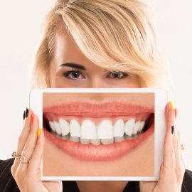Bonding zębów – nowoczesna metoda poprawy uśmiechu